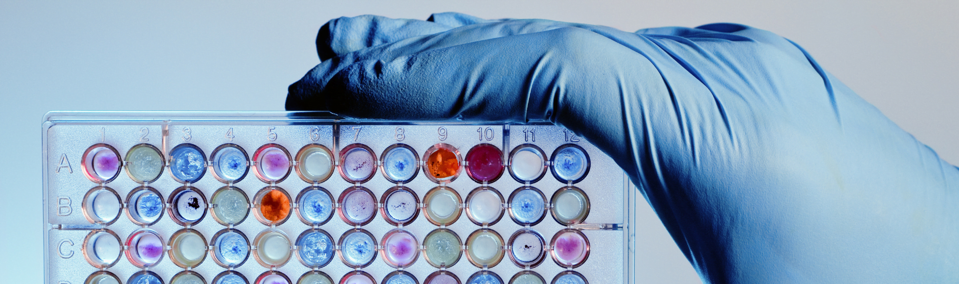 ASSAY KIT - ALFAGEN